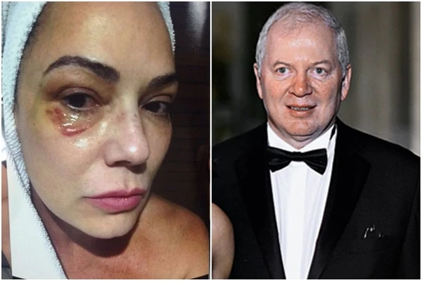 Justiça de SP manda Lirio Parisotto pagar R$ 150 mil a Luiza Brunet por agressão em Nova York